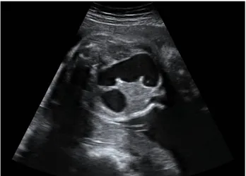 Fig. 1. Sonographic examination of the fetus at 34 weeks of 