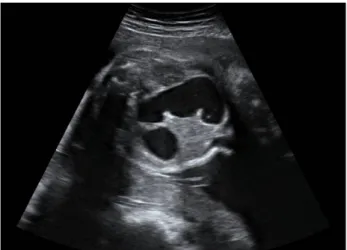 Fig. 1. Sonographic examination of the fetus at 34 weeks of 