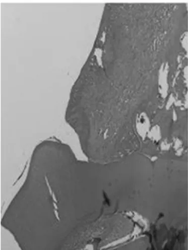 Figure 3. Biphasic calcium phosphate 8 weeks( 40, H-E). ×Figure 2. Control 8 weeks( 40, H-E).×