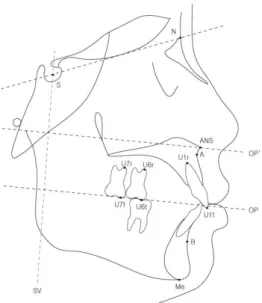 Fig 2. Cephalometric landmarks and planes 