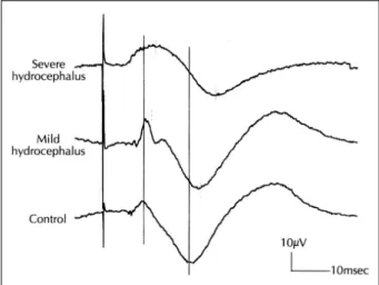 Fig. 10. Change of somatosensory evoked field potential acc-