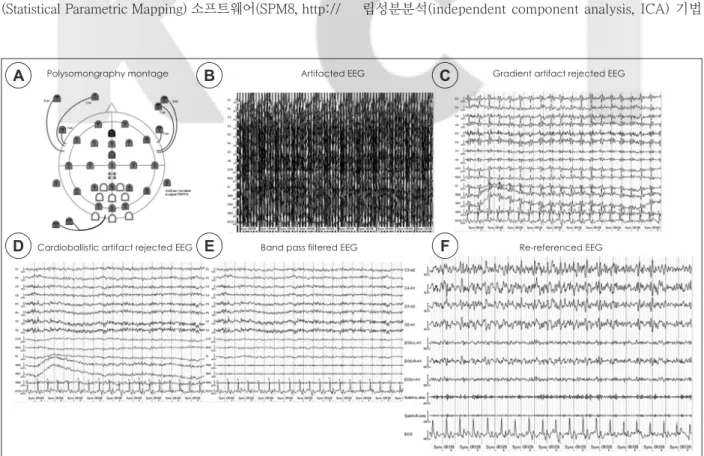 Figure 1. The EEG preprocessing steps for EEG-fMRI data. A : The polysomnography montage with EEG-cap used in the current 
