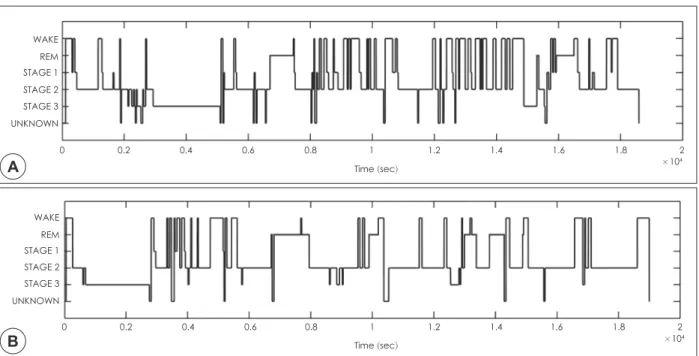 Figure 2. Two examples of hypnogram for EEG-fMRI sleep study.