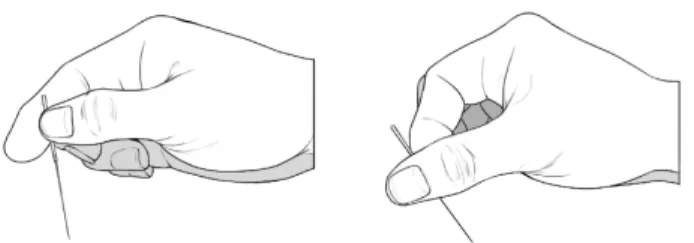 Fig.  1.  Twirling  supplementation  and  draining.  The  left  rotation technique  is  a  reinforcing  method  performed  by  moving  the  thumb forward  while  rotating  the  needle.