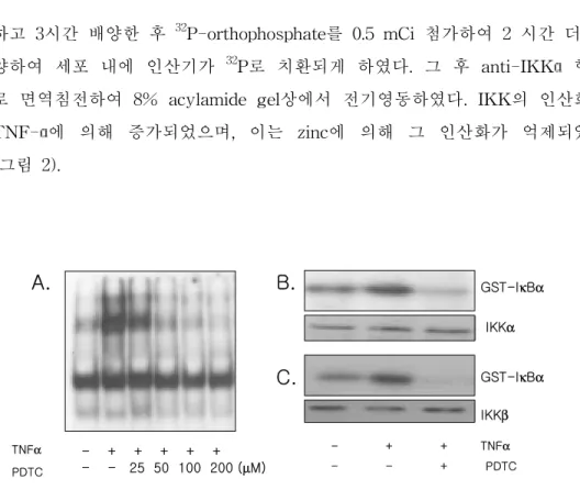 그림 1.  Zinc의 IKK를 경유한 TNF-α에 의한 NF-κB 활성 감소 확인. A. EMSA를