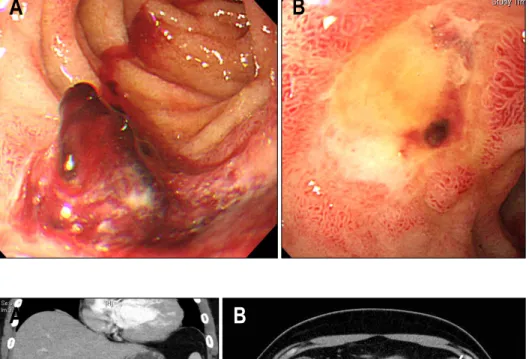 Fig.  2.  Abdominal  CT  scan 