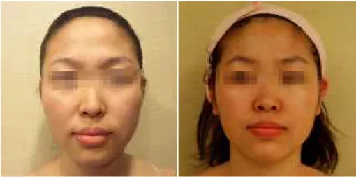 Fig. 2. Before(left) and after(right) the hand massage