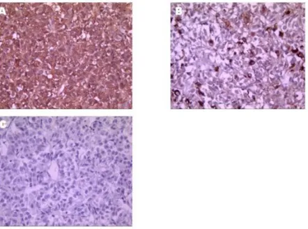 Fig.  4.  Flow  chart  of  IGF-1  level.  Serial  change  of  IGF-1  level  before  and                  after  surgery