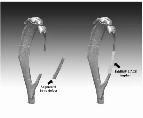 Figure 2. Schematic drawing of ErhBMP-2/ACS implant inserted into the bony 