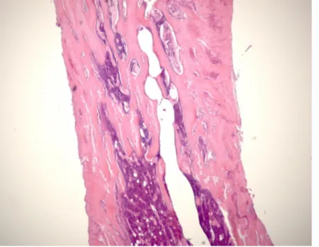Figure 9. x50 magnification of 2weeks group : Border area  New immature woven bone was seen