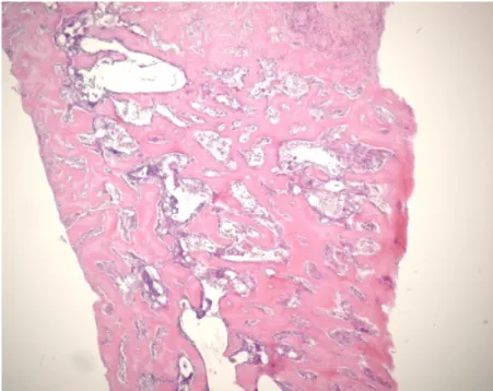 Figure 10. x50 magnification of 2weeks group : Experimental area  New immature woven bone was seen