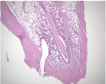 Figure 15. x50 magnification of 8weeks group : Border area 