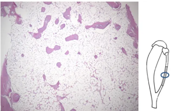 Figure 16. x50 magnification of 8weeks group : Experimental area  The woven bone that was observed at 2 weeks was replaced with bone  marrow