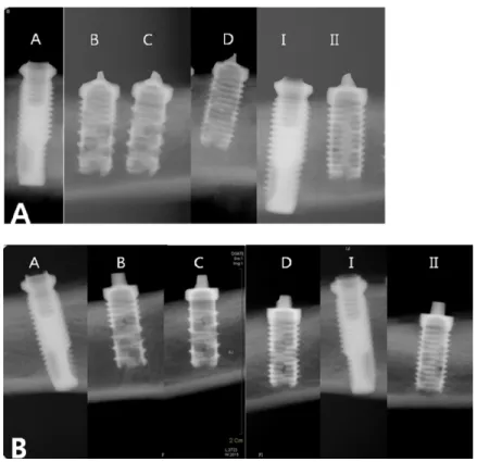 Figure 5. Radiographic(plain X-ray) findings    A. 4-week side 
