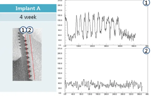 Figure 7. Comparison of bone density(implant A)   