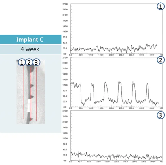Figure 9. Comparison of bone density(implant C) -continued 
