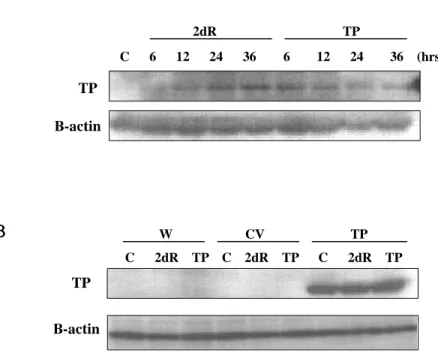 Figure 8. TP and 2dR has no effects on FAK phosphorylation Figure 8. TP and 2dR has no effects on FAK phosphorylationFigure 8