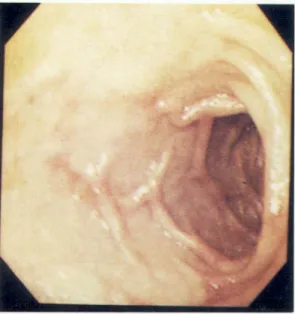 Fig. 3. MRI finding. Brain MRI shows no gross abnor- abnor-mality.