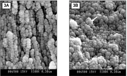 Figure 3. SEM micrograph of remineralized enamel of group 1. 