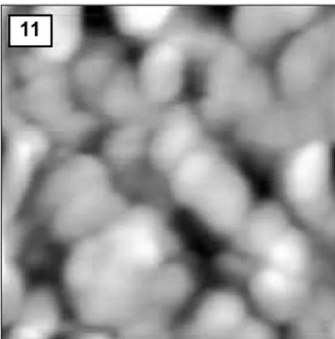 Figure 10. AFM  image  of  hydroxyapatite  crystals  of normal enamel (1.0 ㎛ × 1.0 ㎛)