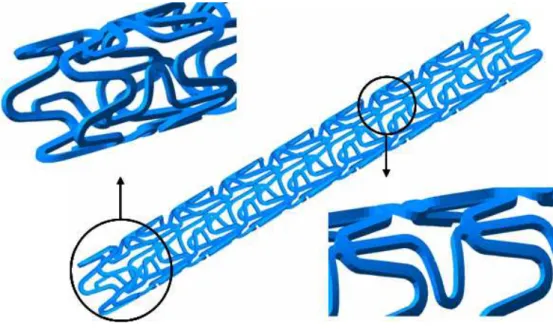 그림  2.6  맥  Q23  스텐트(MAC  Q23  Stent)