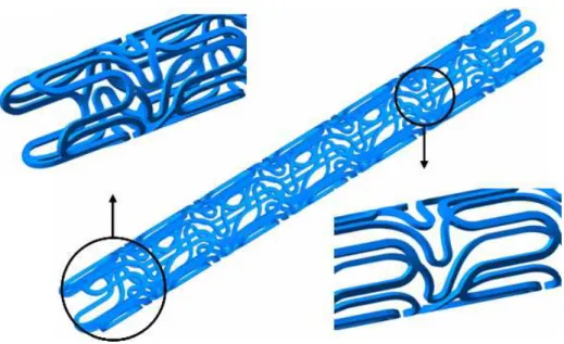 그림  2.7  맥  스텐다드  스텐트(MAC  Standard  Stent)