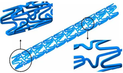 그림  2.9  맥  플러스  스텐트(MAC  Plus  Stent)