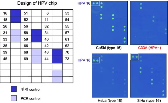 그림  1.  DNA  chip을  이용한  자궁경부암  세포주의  HPV  아형  검사.  HeLa는  HPV  18  양성,  CaSki와  SiHa는  HPV  16  양성이었고  C33A는  음성이었다.
