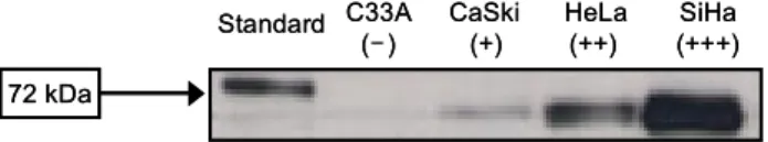 그림  2.  Western  blot법으로  자궁경부암  세포주의  COX-2  발현  측정.  72  kDa의  COX-2가  C33A에서는  발현되지  않았 고  나머지  3가지  세포주에서는  발현되었다.