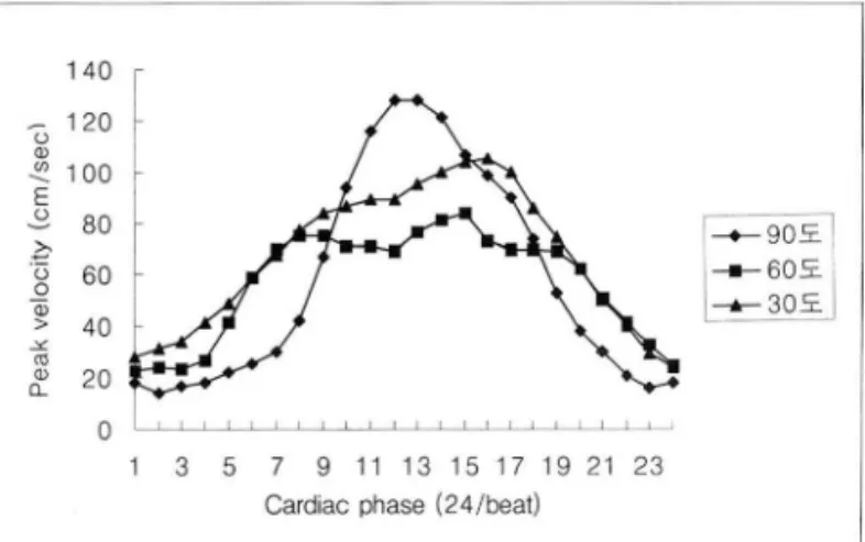 Fig .  4.  The  time - peak  velocity  curve  of rena l  arteries  in a  pulsatile  flow
