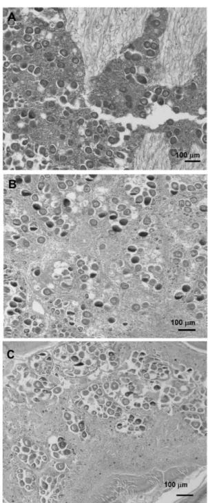 Fig. 5. Frequency distribution of different gametogenic stages of female Ruditapes philippinarum at the sampling sites