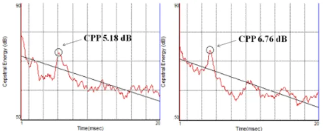 Figure 1. The CPP in the MTD(left) and the control groups(right)  in sentence utterance MTD의 청지각적 평가는 음성장애 진단 및 치료경험이 3년  이상인 언어재활사 3명이 수행하였다