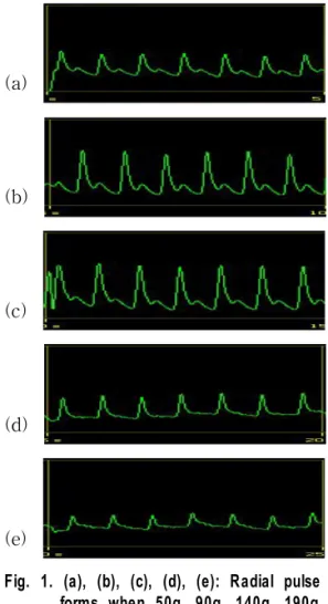 Fig.  1.  (a),  (b),  (c),  (d),  (e):  Radial  pulse  wave  forms  when  50g,  90g,  140g,  190g,  240g  pressure  was  applied  respectively 
