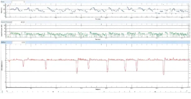 Figure 1. Screen display of running speech protocol after 