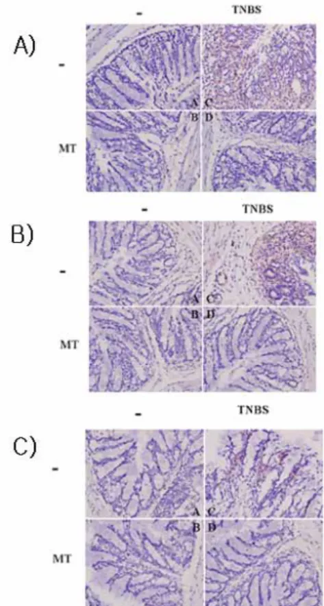 Figure 7. The effect of preemptive Moxi-tar herbal  acupuncture on the IkB-α  degradation in  TNBS-induced colitis