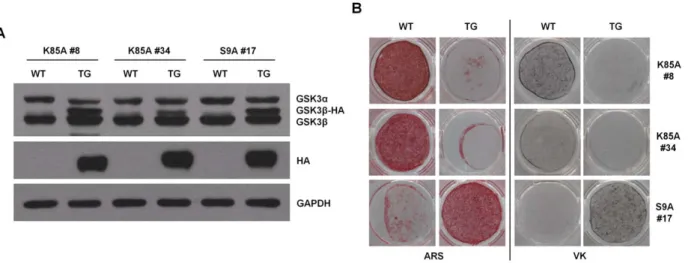 Figure 4. GSK3b regulates osteoblast differentiation in ADSCs of transgenic mice expressing GSK3b mutants
