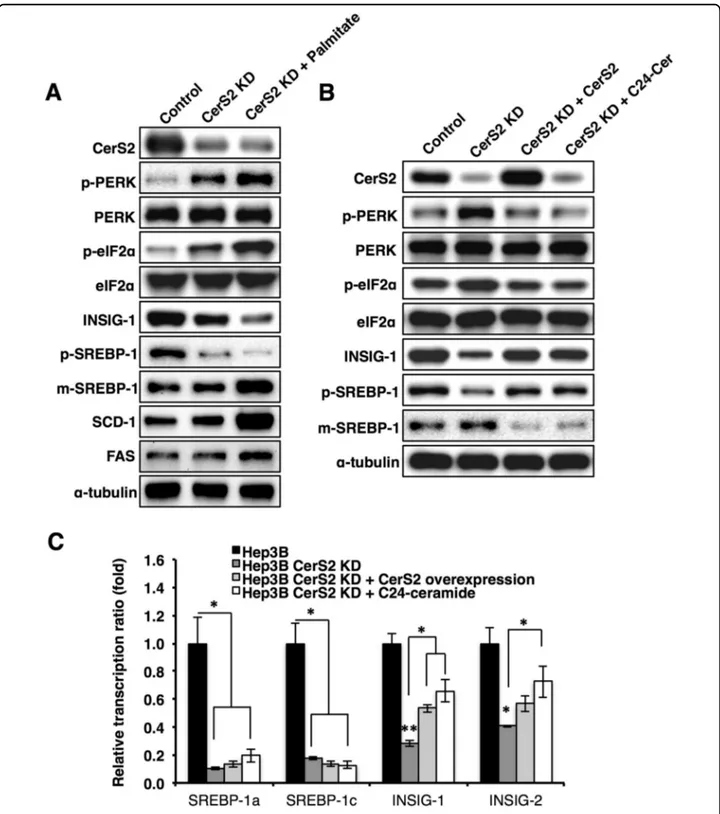 Fig. 4 CerS2 knockdown increases the ER stress response in Hep3B cells. a Representative Western blots of ER stress and lipogenic pathway components in knockdown Hep3B cells with or without palmitate treatment