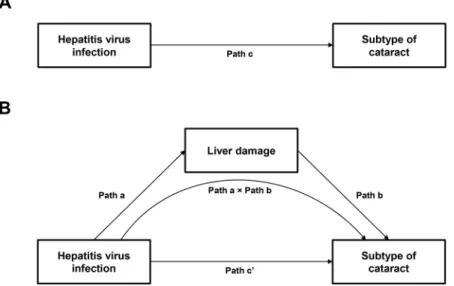 Figure 3.  Hypothesized mediation pathway in the association between hepatitis B virus (HBV) or hepatitis C  virus (HCV) infection and subtype of cataract through liver damage