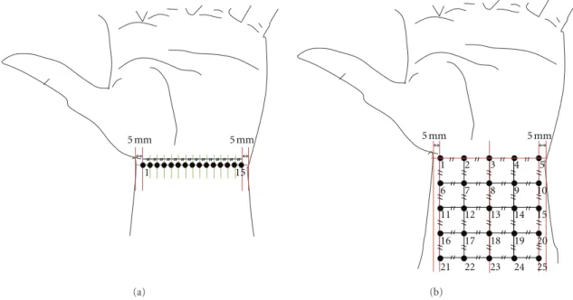 Figure 1: Schematic illustration for the points on the wrist skin where an oxygen microsensor was positioned for pO 2 analysis: (a) one-