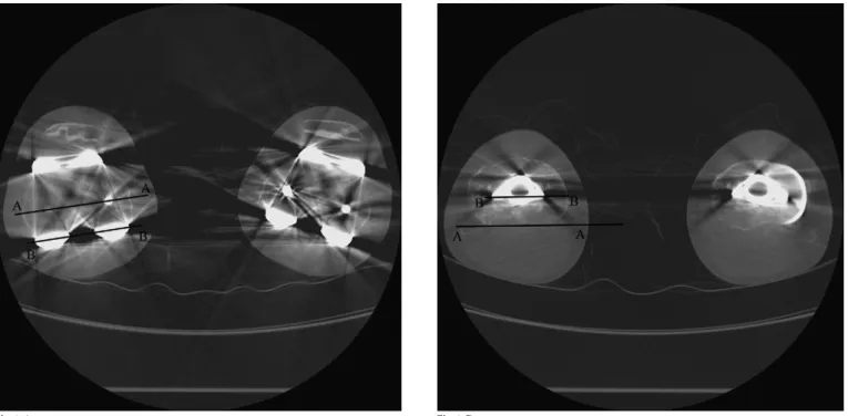 Fig. 1-A Fig. 1-B