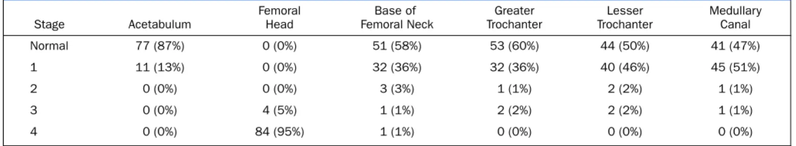 TABLE III Results of Bone Biopsies According to the Histologic Stages described by Arlet and Ficat 8