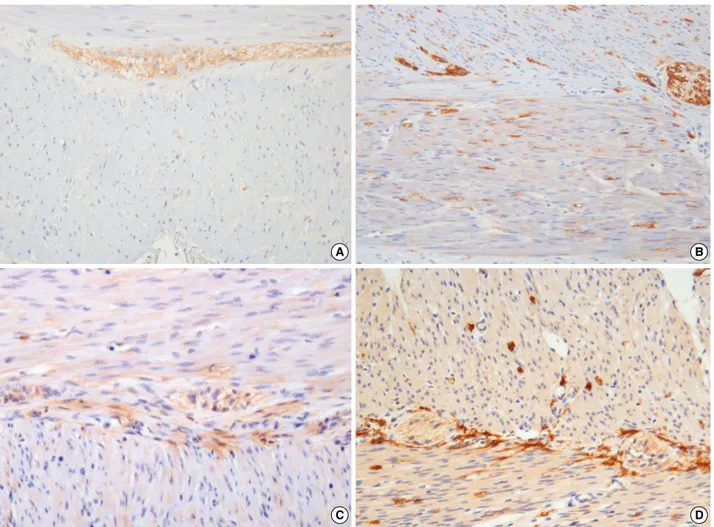Fig. 3. Expression of neuronal cell adhesion molecule (NCAM) positive nerve fibers and c-kit positive interstitial cells of Cajal-myenteric (ICC- (ICC-MY)
