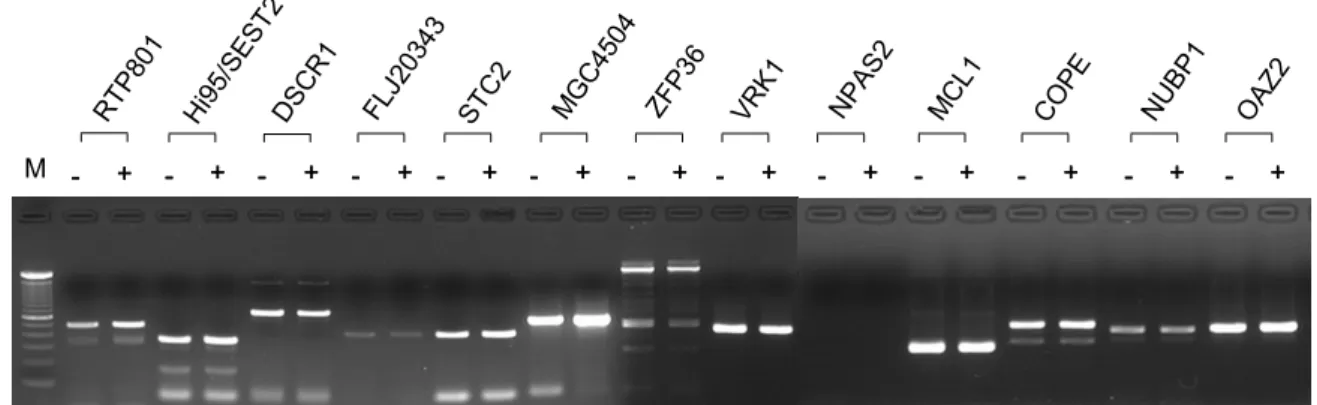 Figure 2. RT-PCR analysis of Aβ -responsive genes. Cells were incubated in the absence (-) or in the presence (+) of 10  µ M of A β (1-42) for 6 h and harvested