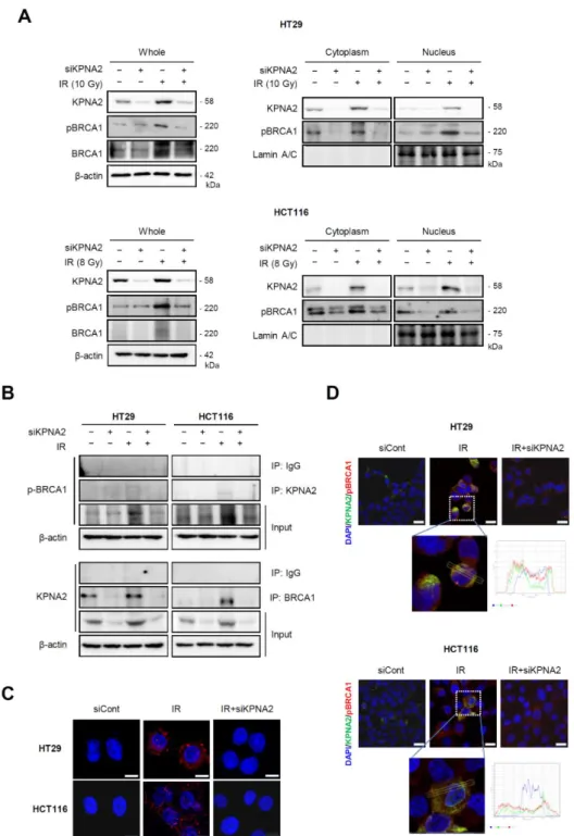 Figure  3.  KPNA2  depletion  interferes  with  the  activation  of  radiation-induced  BRCA1  proteins