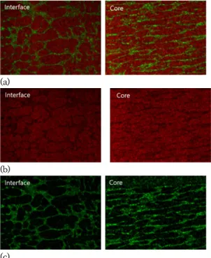 Fig. 6. Composition maps of (a) Al and Si, (b) Al and  (c)  Si  at  melting-pool  interface  and  core Fig