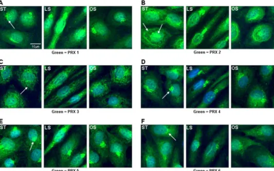 FIGURE 2. LS stimulated PRX 1 expression in BAEC. Confluent BAEC were exposed to LS, OS, or static condi- condi-tions for 1 day as in Fig