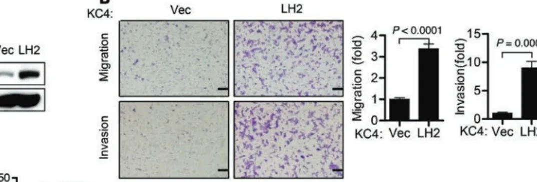 Figure 9. Ectopic LH2 increases KC4 tumor size and metastasis. (A) Q-PCR analysis (bar graph) 