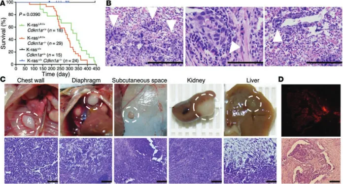 Figure 1. p21 loss confers metastatic capacity to lung adenocarcinomas in K-ras LA1  mice