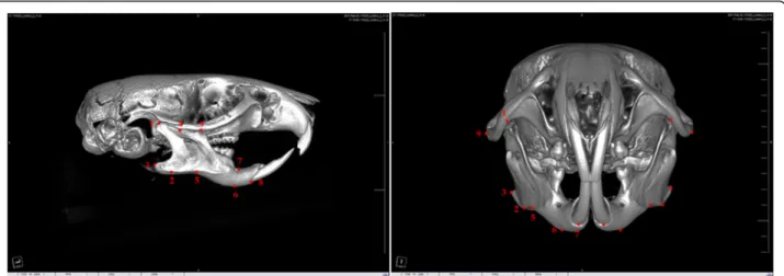 Fig. 1 Anthropometric measurement points. (1) Condylion (Cd) —most posterior and superior points on the mandibular condyle