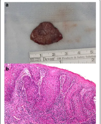 Fig. 2 a Gross anatomy. Macroscopically, the excised specimen had dimensions of 2.1 × 2.0 × 0.3 cm